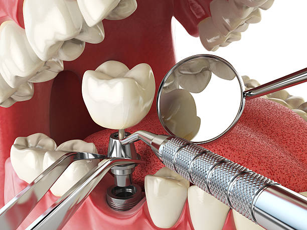 Best Emergency Care for Gum Disease in Maple Heights, OH